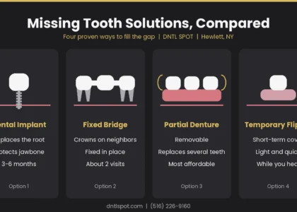 Missing tooth solutions compared: dental implant, bridge, partial denture and flipper