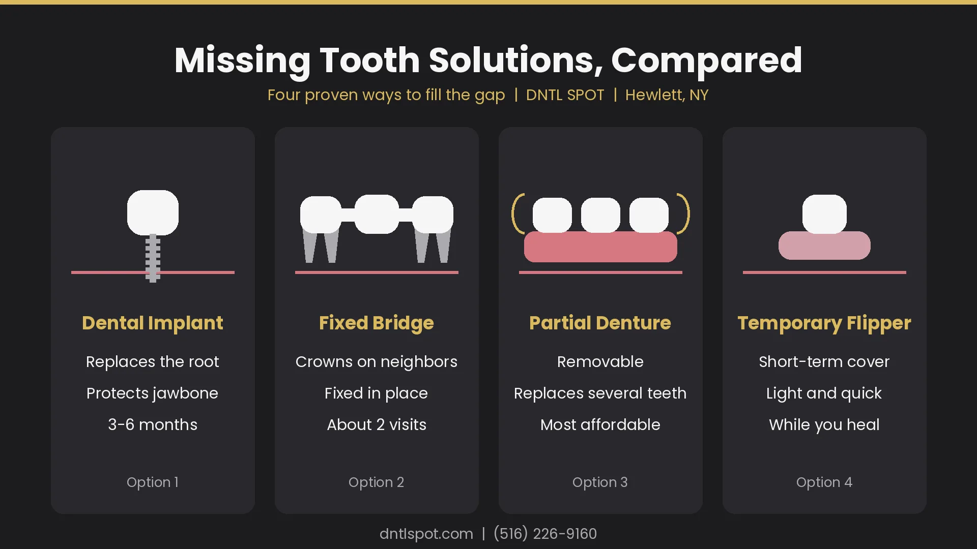 Missing tooth solutions compared: dental implant, bridge, partial denture and flipper